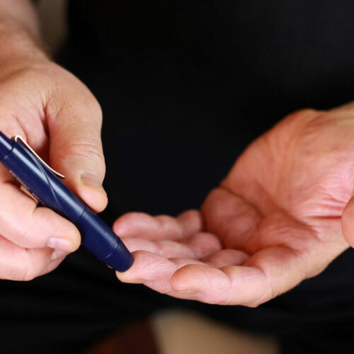 Here are a few common causes and symptoms of type 2 diabetes