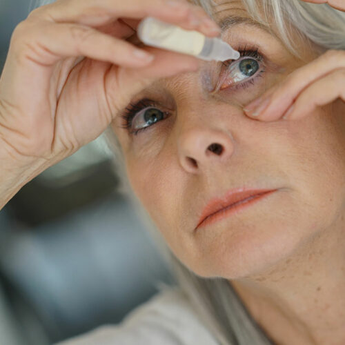 Dry eyes – Symptoms, causes, and treatment