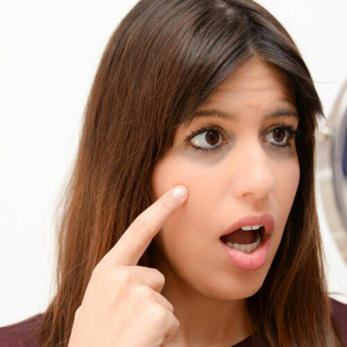 Here’s How to Fix Your Dark Circles Like a Pro