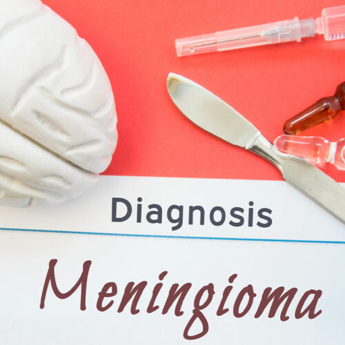 Meningioma – Symptoms, Causes, Diagnosis, and More